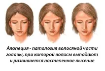 причини причини