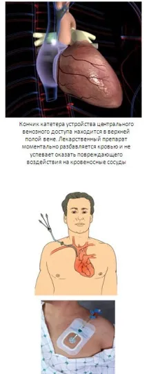 Найкращий варіант профілактики... профілактики