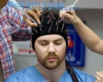 Нейрональний епілептогенез епілептогенез