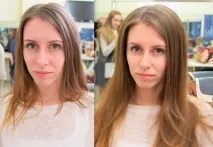 Буст Ап для волосся відгуки, фото до і після на коротке, довге та середнє волосся фото