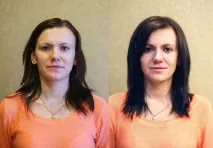 Буст Ап для волосся відгуки, фото до і після на коротке, довге та середнє волосся відгуки