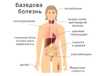 Дифузний токсичний зоб симптоми та лікування, Just My Beauty токсичний