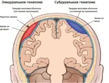 възможности