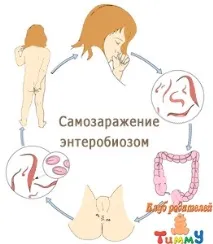 Ентеробіоз огляд захворювання та рекомендації з лікування, Клуб батьків Tummy ентеробіоз