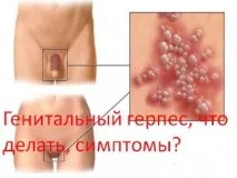 симптоми симптоми