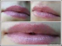 губна