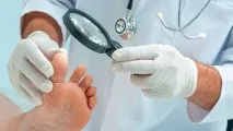 лекува краката