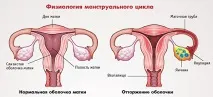 определя определя