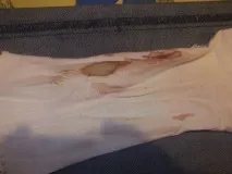 кръв отделяния