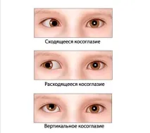 лечение дете