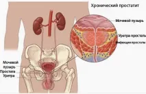 аднекситу