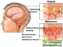последици лечение