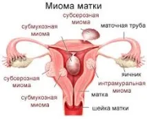 матката матката