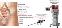 простати