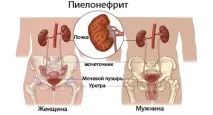 лечение лечение