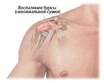симптоми симптоми