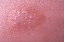 дете реакция