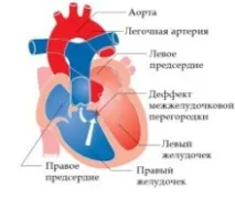 причини