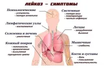 симптоми симптоми