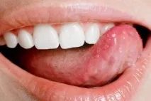устната кухина устната кухина
