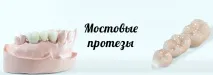 Протезування зубів Ціни, види, в Дедовськ Протезування зубів вінірами, коронками, люмінірами, протезування