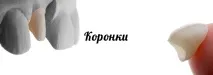 Протезування зубів Ціни, види, в Дедовськ Протезування зубів вінірами, коронками, люмінірами, протезування