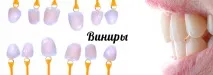 Протезування зубів Ціни, види, в Дедовськ Протезування зубів вінірами, коронками, люмінірами, протезування