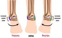 гомілкостопу