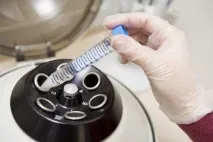 Розкрито механізм появи онкомаркерів у слині, MedPro появи