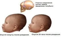 размер бебе