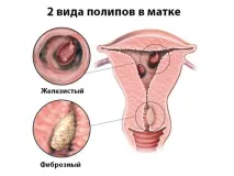 лікування