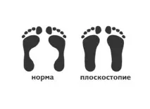 Статична деформація стопи, EUROLAB, Травматологія статична