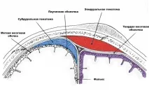 мозъка субдурален