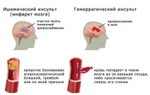 възстановяване причини