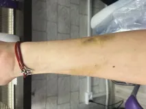 ухапване какво подтикна