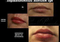 Збільшення губ за допомогою татуажу допомогою