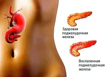 панкреаса панкреаса