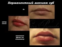 Збільшення губ за допомогою татуажу татуажу