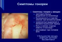 Виділення з уретри (сечового каналу) у жінок уретри
