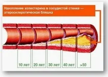 У чому небезпека підвищеного рівня холестерину чому