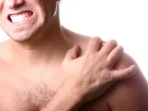 Вивих ключиці ключиці