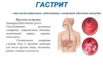 лечение симптоми