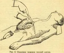 ВИКРИТТЯ І ОГЛЯД ЧЕРЕВНОЇ ПОРОЖНИНИ огляд