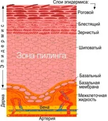 Хімічні пілінги у Курську - Косметологія, Дерматологія - Меділайн, Льгов хімічні