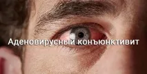 конюнктивит конюнктивит