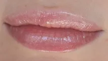 блиску