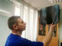 9 питань, які варто поставити перед ендопротезуванням колінного суглоба варто