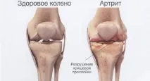какво какво