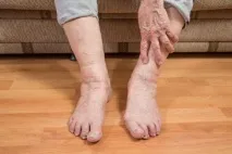 симптоми причини