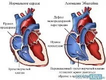 ебштейна